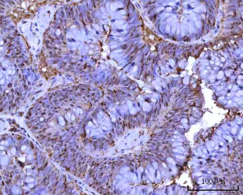  IHC analysis of RRP1 using anti-RRP1 antibody (A06230-1)