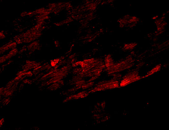 Immunofluorescence of SPG15 in Mouse Heart tissue with SPG15 antibody at 20 μg/mL
