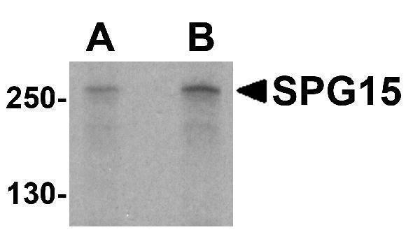 Western blot analysis of SPG15 in K562 cell lysate with SPG15 antibody at (A) 1 and (B) 2 μg/mL