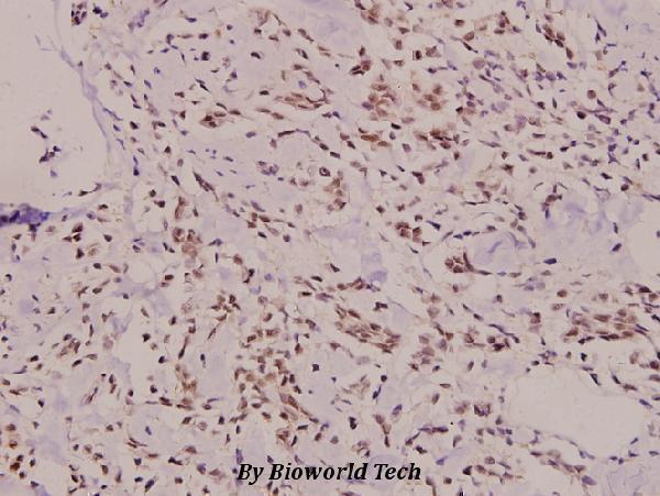 a06232 1 sh2d2a primary antiboties ihc testing 2