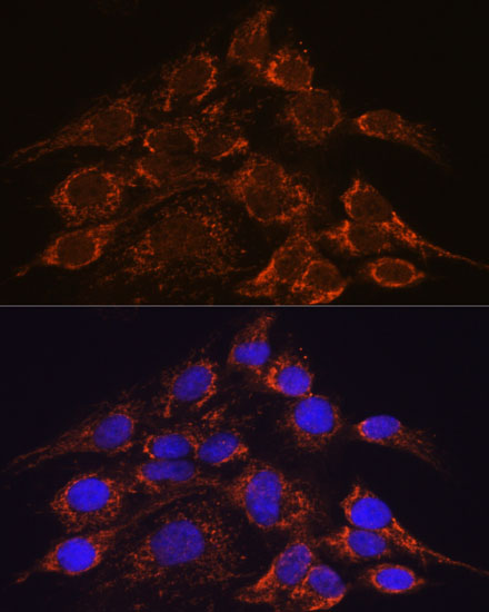 Immunofluorescence analysis of C6 cells using HPS4 antibody  at dilution of 1:100