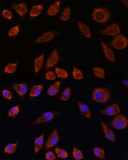 Immunofluorescence analysis of L929 cells using HPS4 antibody  at dilution of 1:100