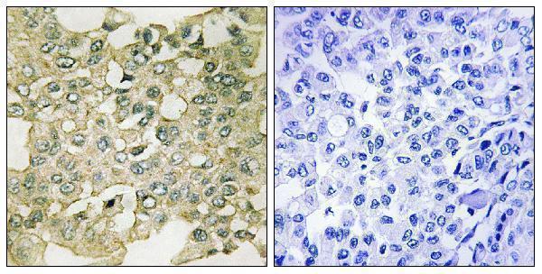 a06247s83 pkmyt1 primary antibodies ihc testing 2