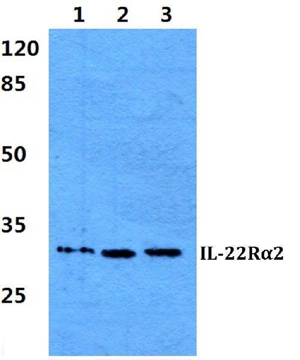 a06250 il22ra2 primary antiboties wb testing 1