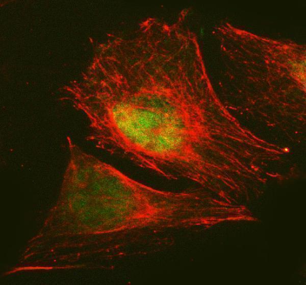  IF analysis of RANBP3 using anti-RANBP3 antibody (A06252-1) and anti-Tubulin Alpha antibody (M03989-3)