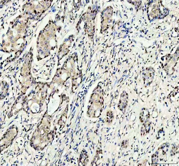  IHC analysis of RANBP3 using anti-RANBP3 antibody (A06252-1)