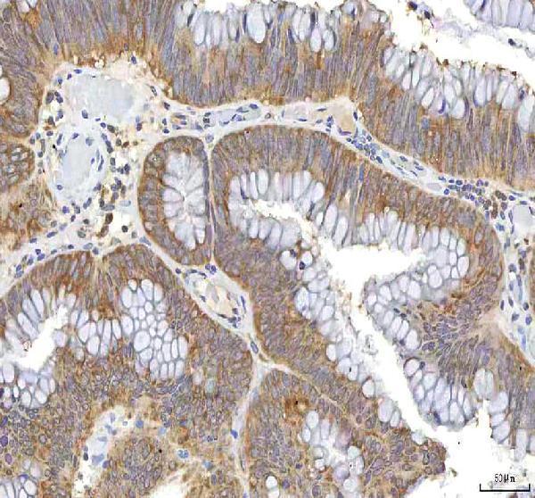  IHC analysis of OCM using anti-OCM antibody (A06253-1)