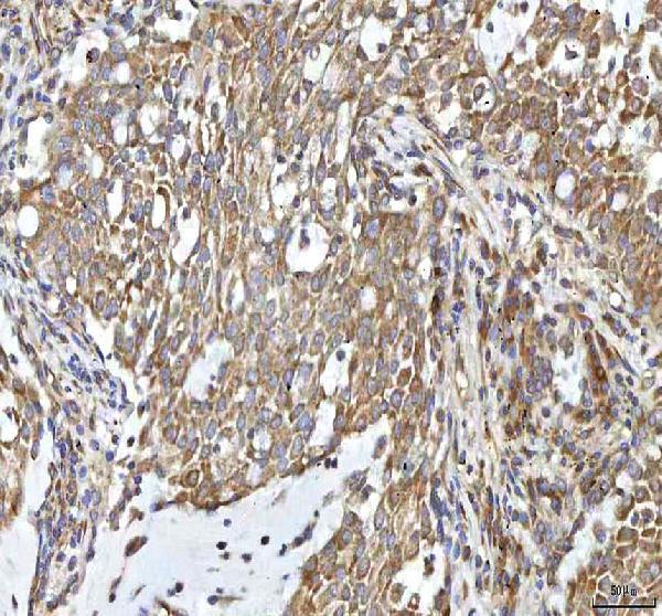  IHC analysis of OCM using anti-OCM antibody (A06253-1)