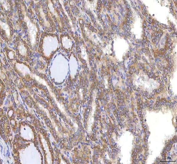 a06253 1 ocm primary antibodies ihc testing 5