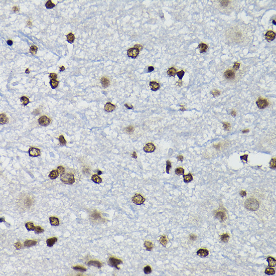 Immunohistochemistry of paraffin-embedded mouse spinal cord using Cyclin K Rabbit pAb  at dilution of 1:100 