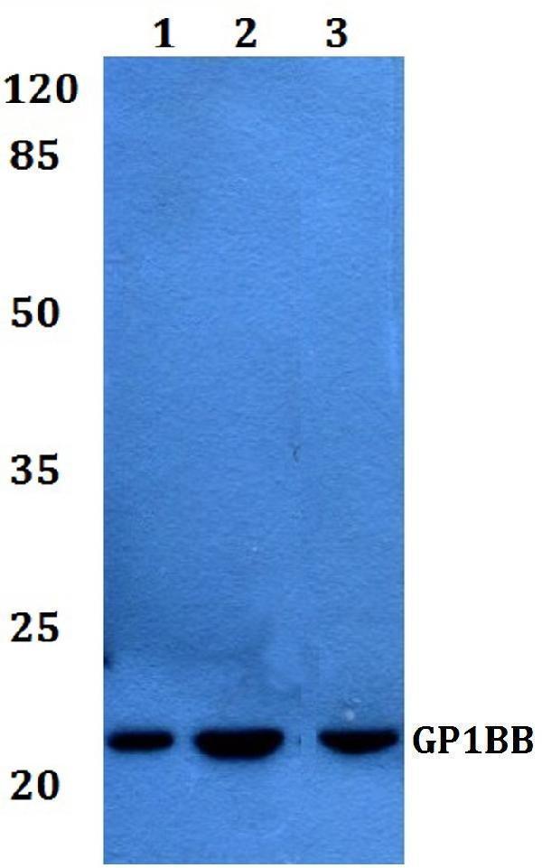 Western blot (WB) analysis of GP1BB polyclonal antibody at 1:500 dilution
Lane1:Jurkat whole cell lysate
Lane2:sp2/0 whole cell lysate
Lane3:Rat heart tissue lysate