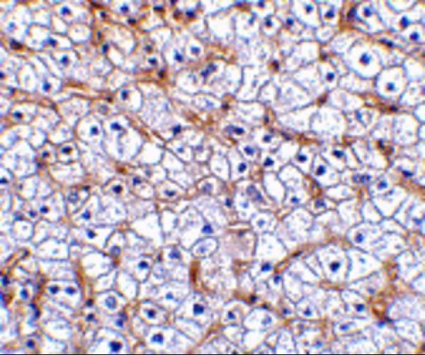 Immunohistochemistry of Fn14 in human liver tissue with Fn14 antibody at 2