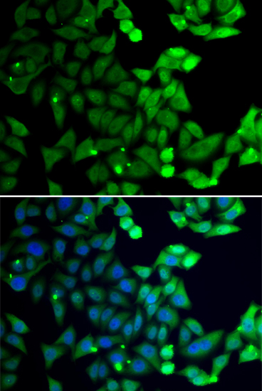 Immunofluorescence analysis of GFP-RNF168 transgenic U2OS cells using UIMC1 antibody 
