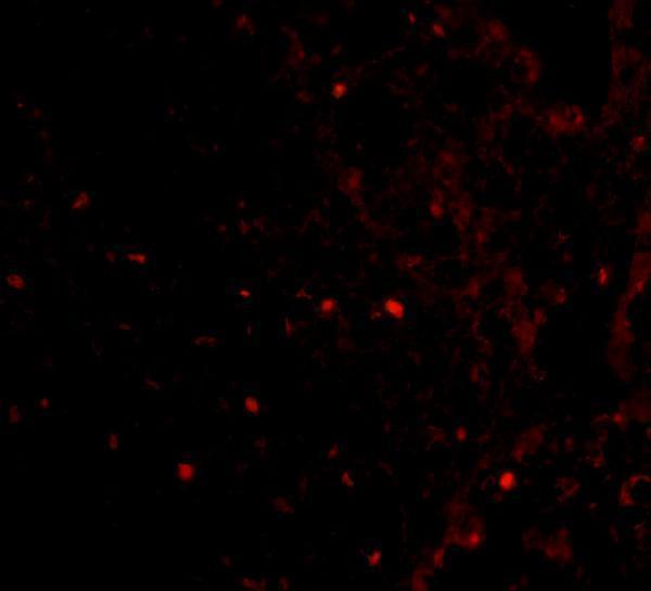 Immunofluorescence of RAP80 in Human Spleen cells with RAP80 antibody at 20 μg/mL
