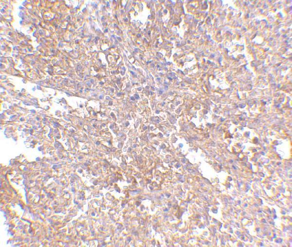 Immunohistochemistry of RAP80 in human spleen tissue with RAP80 antibody at 2