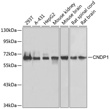 Western blot analysis of extracts of various cell lines, using CNDP1 antibody  at 1:1000 dilution