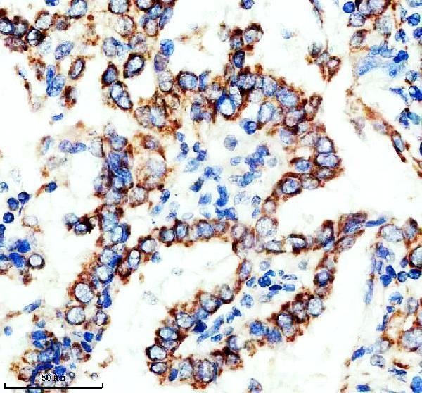 a06266 1 chchd2 primary antibodies ihc testing 1