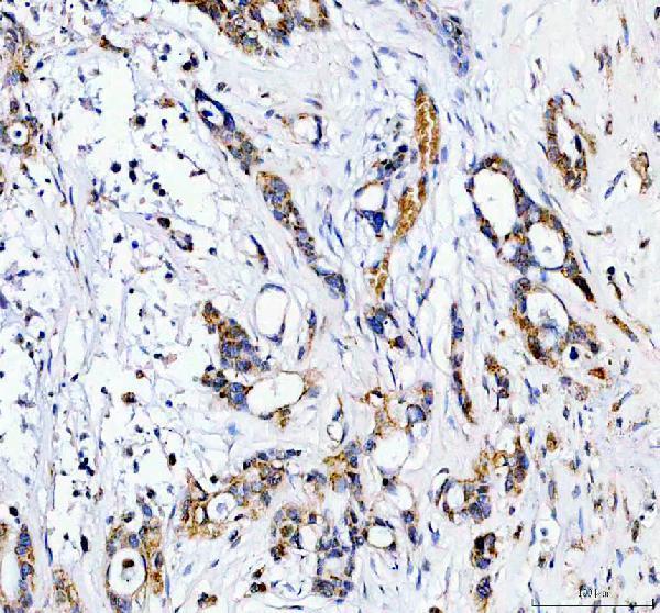a06266 1 chchd2 primary antibodies ihc testing 1_1