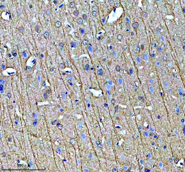 a06266 1 chchd2 primary antibodies ihc testing 2