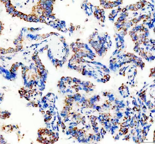a06266 1 chchd2 primary antibodies ihc testing 3