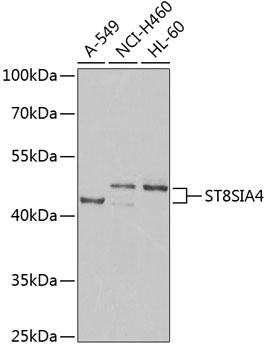 Western blot analysis of extracts of various cell lines, using ST8SIA4 Antibody  at 1:1000 dilution