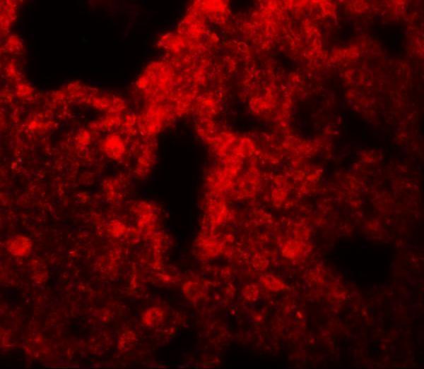 a06268 srpx2 primary antibodies if testing 3