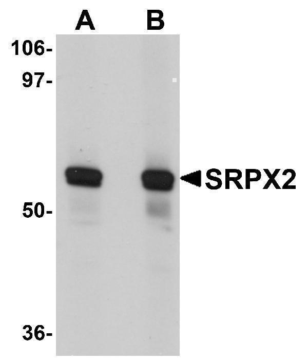 a06268 srpx2 primary antibodies wb testing 1