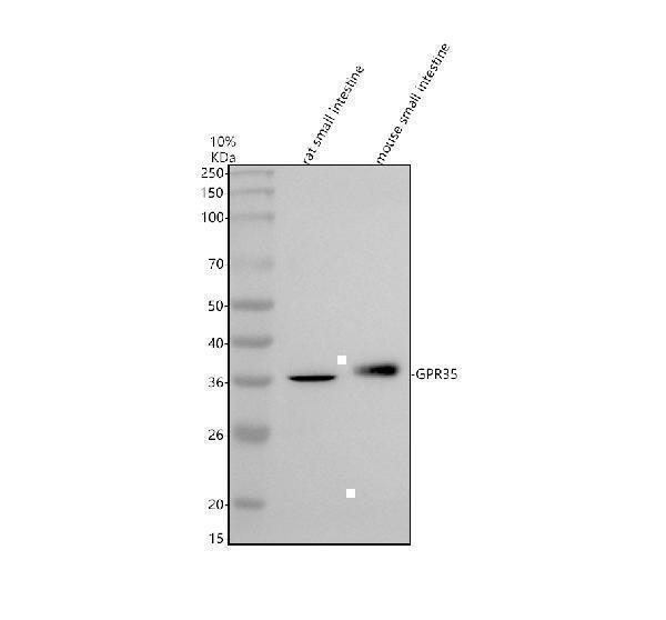  Western blot analysis of GPR35 using anti-GPR35 antibody (A06269-1)