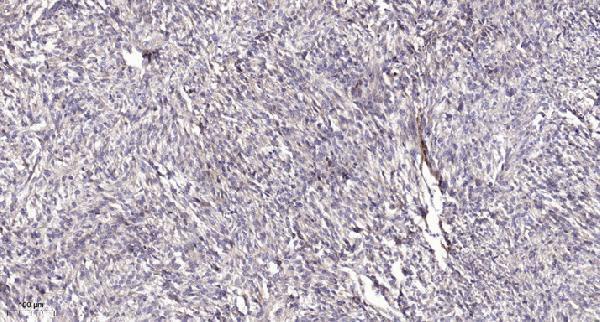 a06270y159 ick primary antibodies ihc testing 1