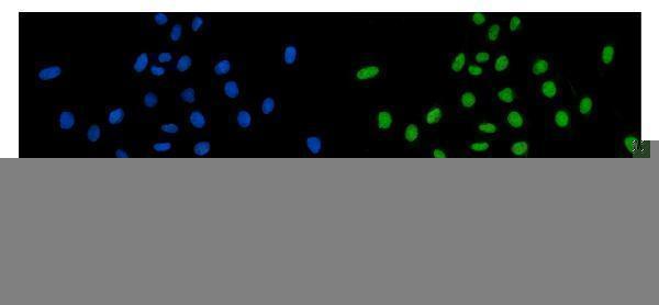 a06272 1 pds5a primary antibodies if testing 2