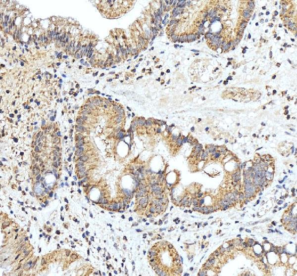 IHC analysis of EDIL3 using anti-EDIL3 antibody (A06273-1)