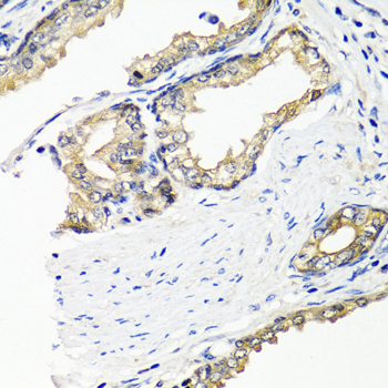 a06273 edil3 primary antiboties ihc testing 2