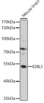 a06273 edil3 primary antiboties wb testing 1
