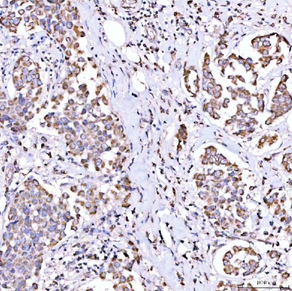 a06274 1 suclg1 primary antibodies ihc testing 2