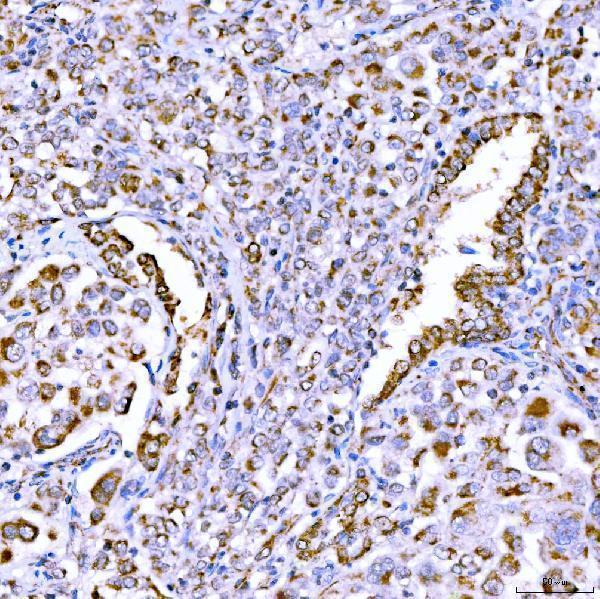 a06274 1 suclg1 primary antibodies ihc testing 3