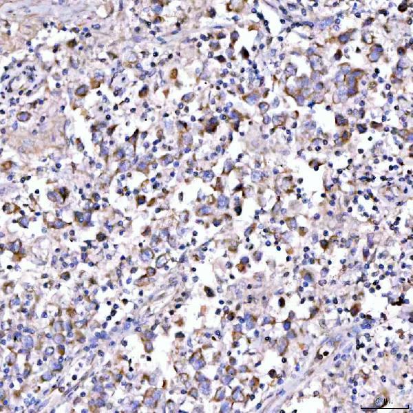 a06274 1 suclg1 primary antibodies ihc testing 4
