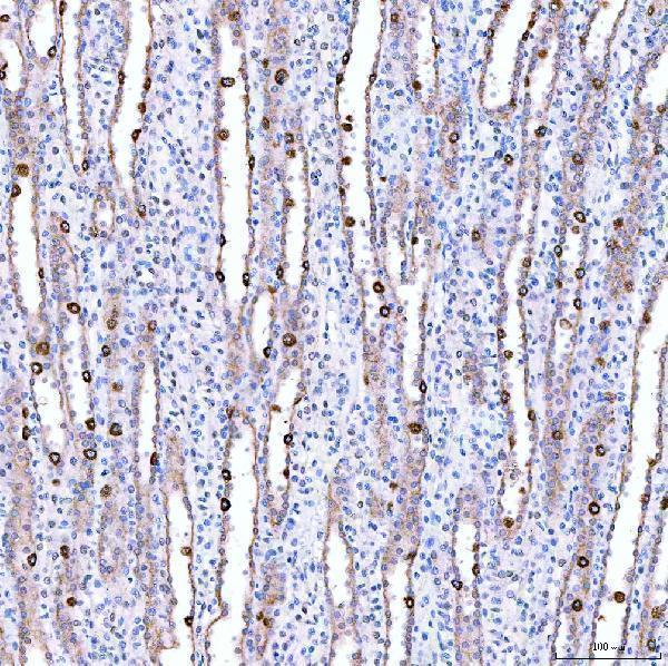 a06274 1 suclg1 primary antibodies ihc testing 5