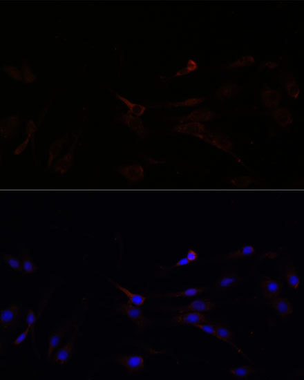 a06274 suclg1 primary antiboties if testing 2