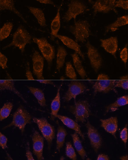 a06274 suclg1 primary antiboties if testing 3