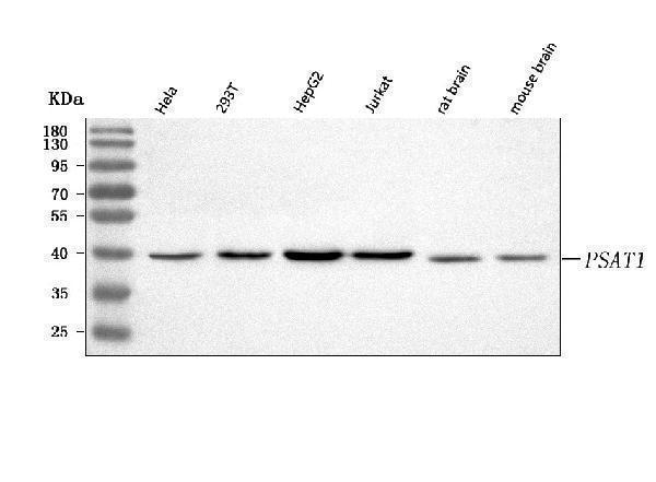  Western blot analysis of PSAT1 using anti-PSAT1 antibody (A06277)