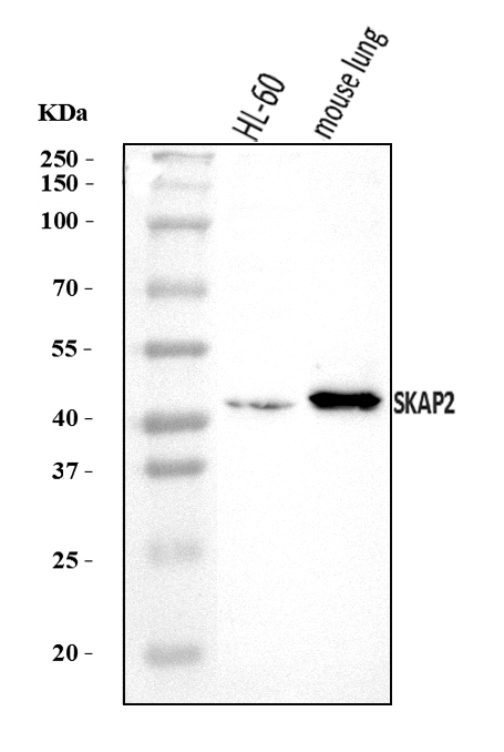  Western blot analysis of SKAP2 using anti-SKAP2 antibody (A06280-2)