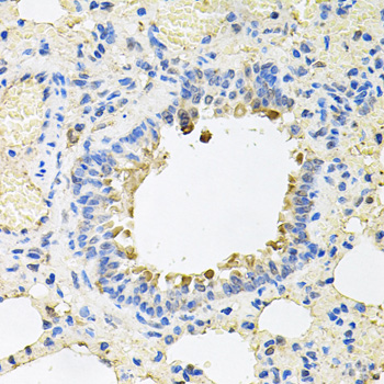 Immunohistochemistry of paraffin-embedded mouse stomach using SKAP2 antibody at dilution of 1:100 (x40 lens)