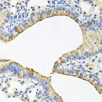 Immunohistochemistry of paraffin-embedded rat lung using SKAP2 antibody at dilution of 1:100 (x40 lens)