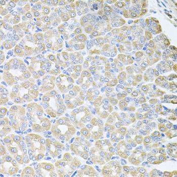 Immunohistochemistry of paraffin-embedded mouse lung using SKAP2 antibody at dilution of 1:100 (x40 lens)