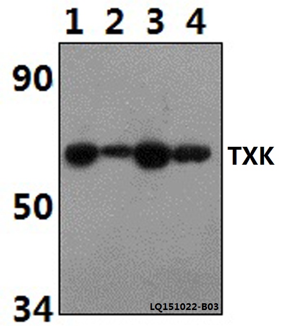 Western blot (WB) analysis of TXK polyclonal antibody at 1:500 dilution
Lane1:Jurkat whole cell lysate(40ug)
Lane2:The Spleen tissue lysate of Rat(30ug)
Lane3:The Spleen tissue lysate of Mouse(30ug)
Lane4:THP-1 whole cell lysate(40ug)