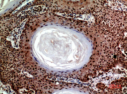a06284 sec22b primary antibodies ihc testing 1