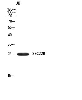 a06284 sec22b primary antibodies wb testing 2