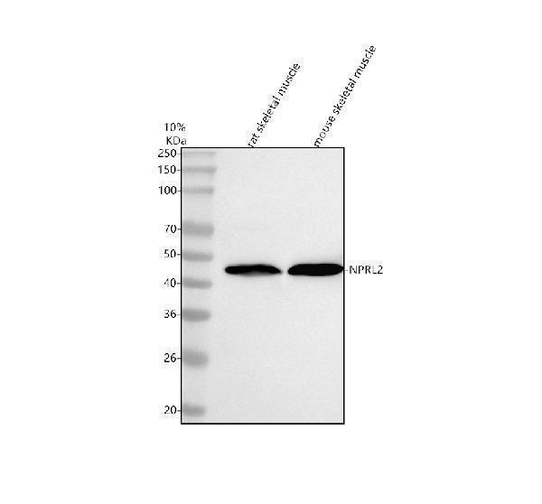  Western blot analysis of NPRL2 using anti-NPRL2 antibody (A06286-3)