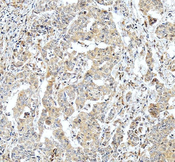 IHC analysis of MTHFD1L using anti-MTHFD1L antibody (A06289-1)