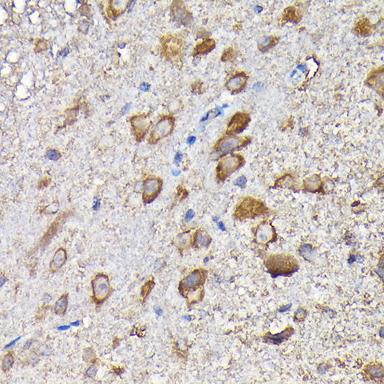 a06289 mthfd1l primary antiboties ihc testing 4